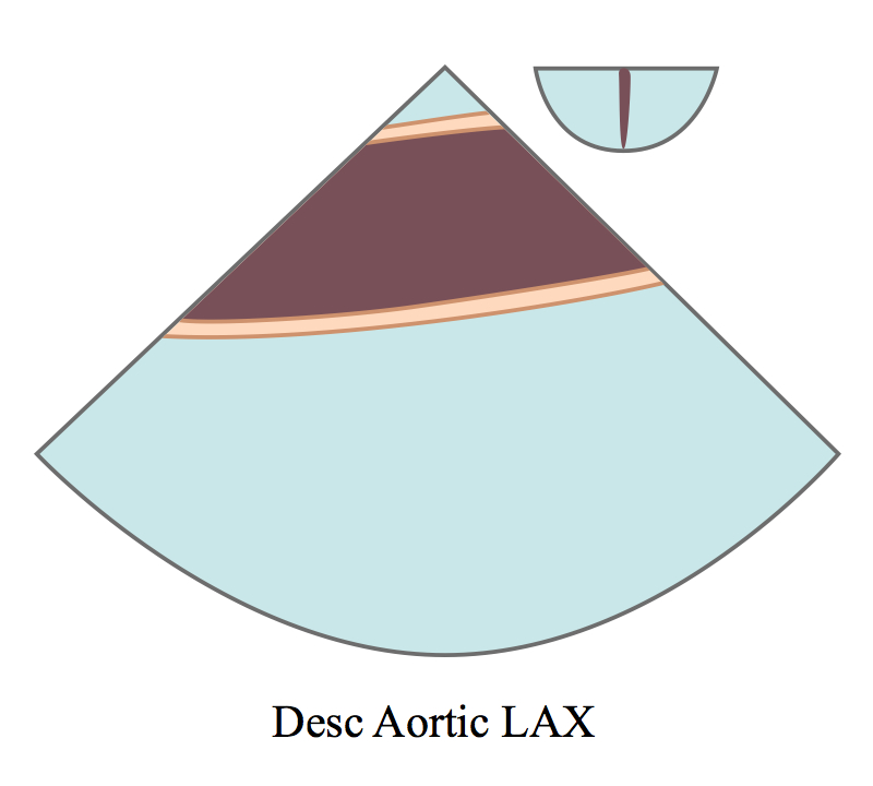 DescendingAorticLongAxis