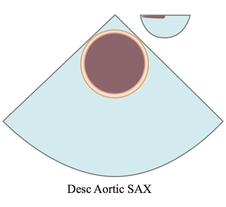 DescendingAorticShortAxis