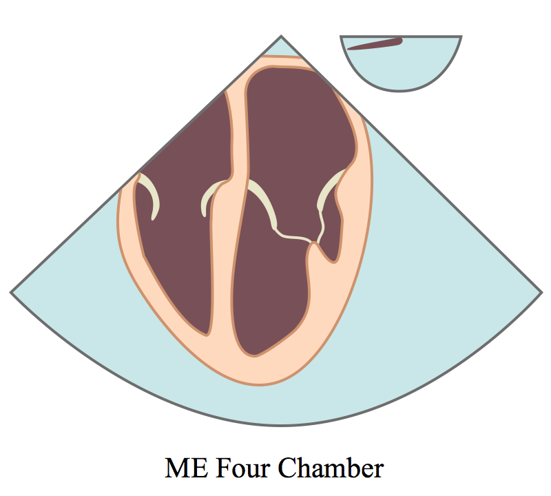 MEFourChamberLine