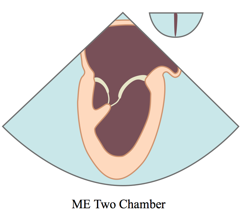 METwoChamberLine