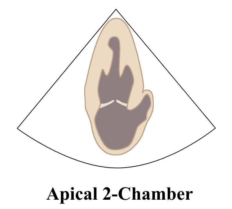 Apical2ChamberLine