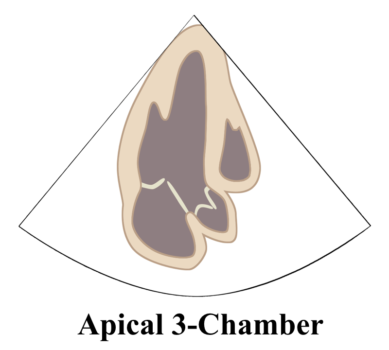 Apical3ChamberLine
