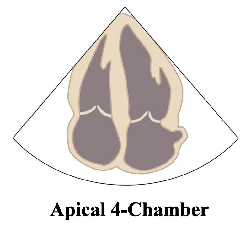 Apical4ChamberLine