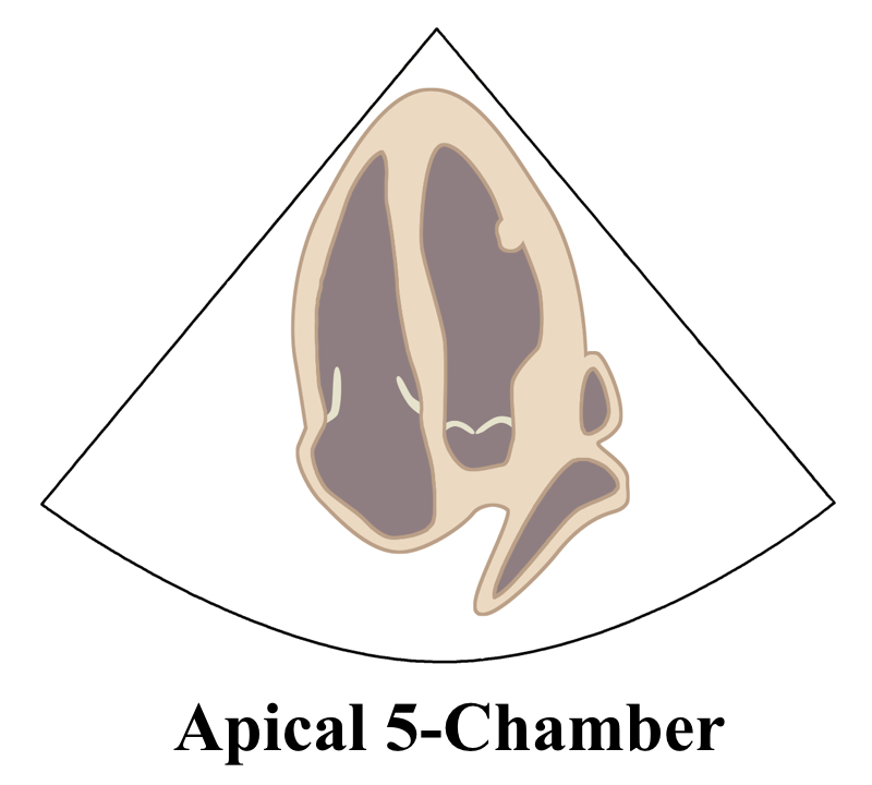 Apical5ChamberLine